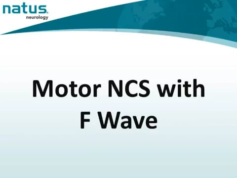 11. UltraPro First Generation Hardware - Motor NCS With F Wave
