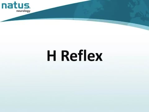 15. UltraPro First Generation Hardware - H Reflex
