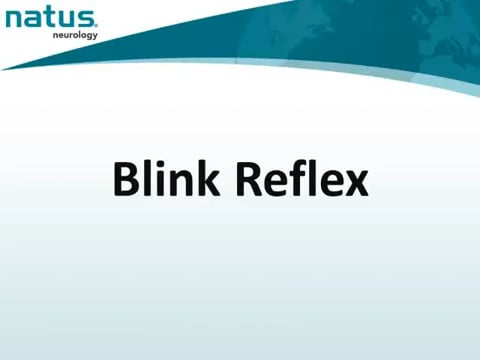 16. UltraPro First Generation Hardware - Blink Reflex