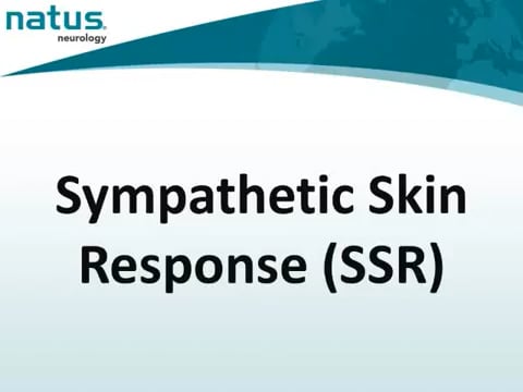 19. UltraPro First Generation Hardware - Sympathetic Skin Response (SSR)