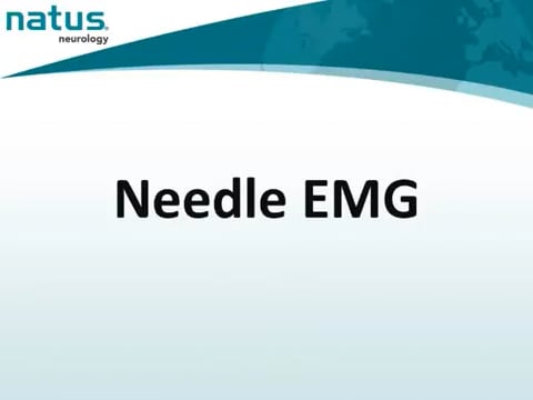 21. UltraPro First Generation Hardware - Needle EMG