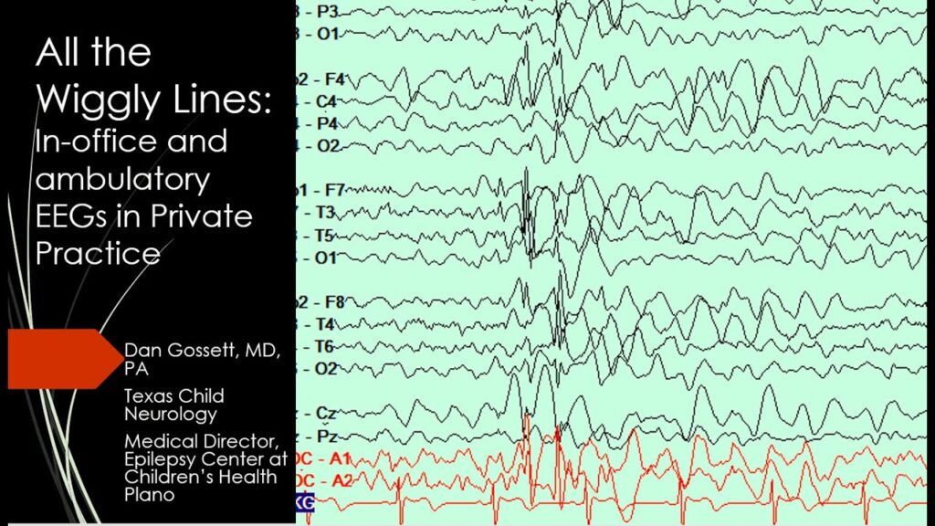 All the wiggly lines in office and ambulatory EEGs in private practice