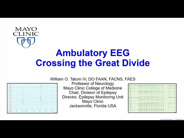 Ambulatory EEG Crossing the Great Divide