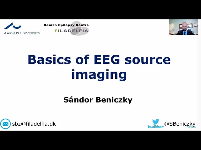 Basics of EEG Source Imagine