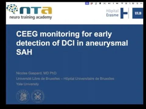 CEEG for early detection and management of delayed cerebral ischemia after SAH