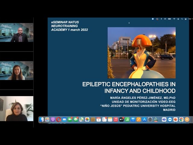 Diagnóstico de Video EEG de las Encefalopatías Epilépticas