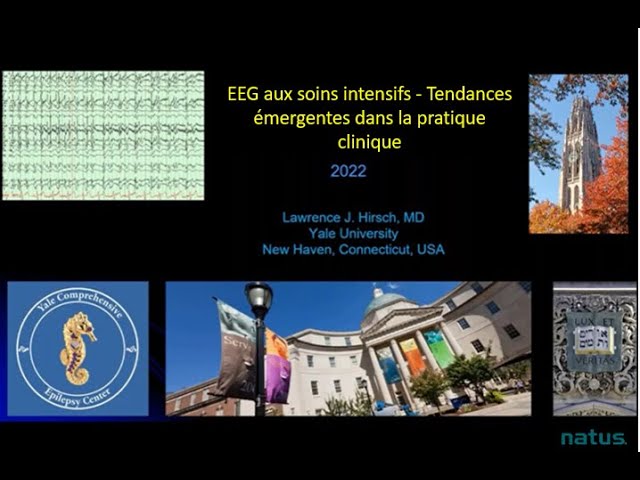 EEG aux soins intensifs - Tendances émergentes dans la pratique clinique