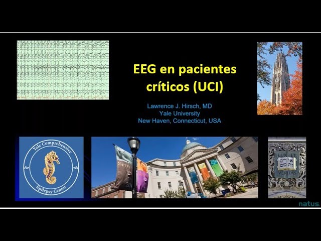 EEG en pacientes críticos