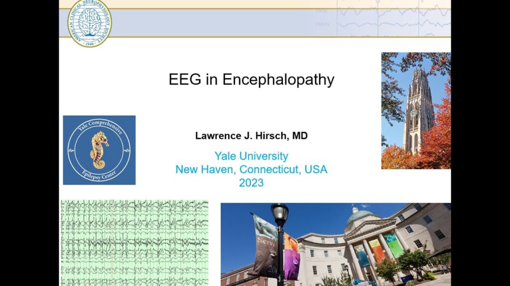 EEG in Encephalopathy