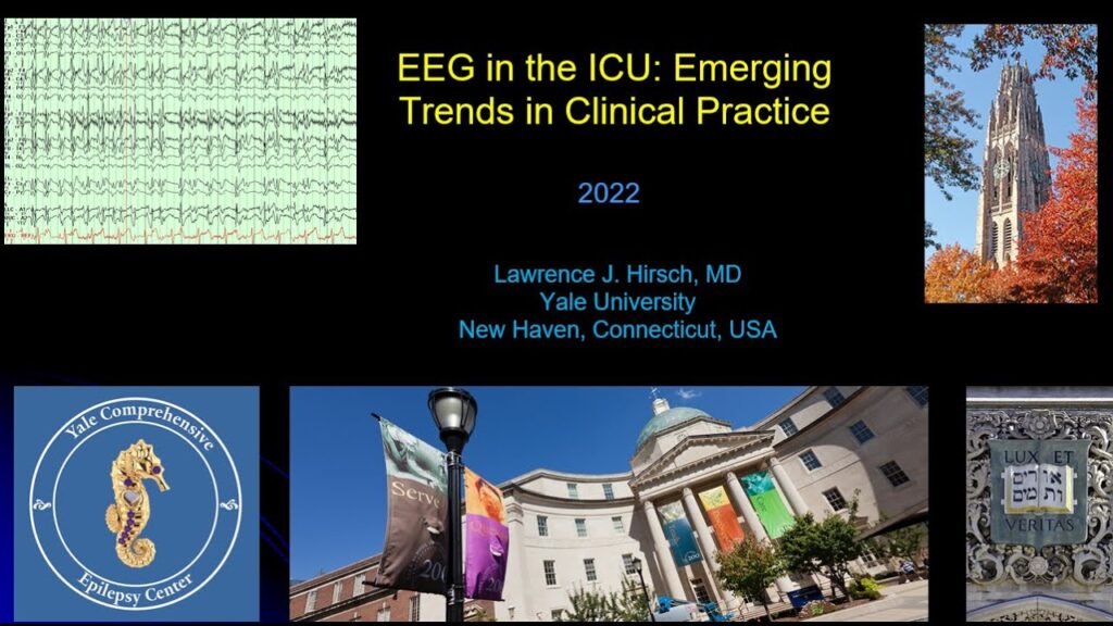 EEG in ICU: Emerging Trends in Clinical Practice