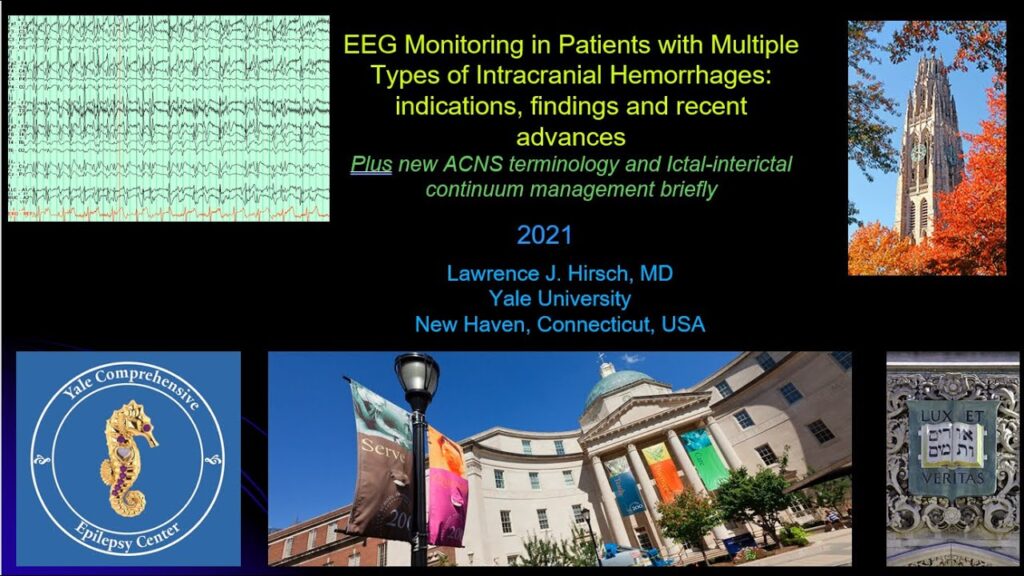 EEG in Intracranial Hemorrhage