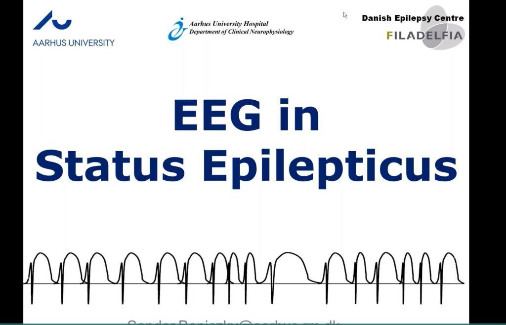 EEG in status epilepticus