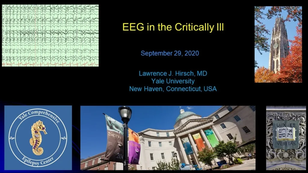 NTA seminar EEG in the Critically ILL
