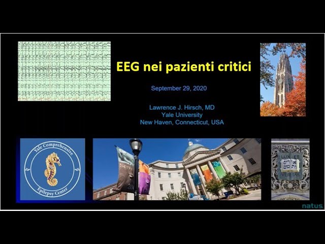 EEG nei pazienti critici