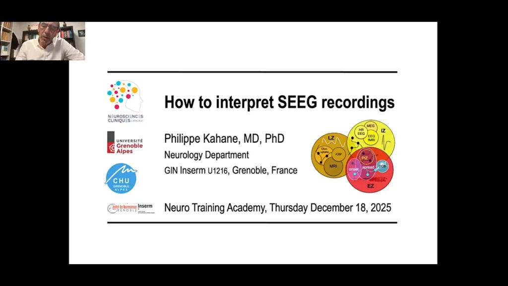 How to Interpret SEEG Recordings