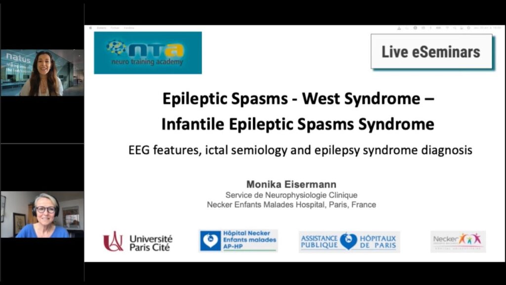 Infantile Epileptic Spasms Syndrome – EEG features, ictal semiology and epilepsy