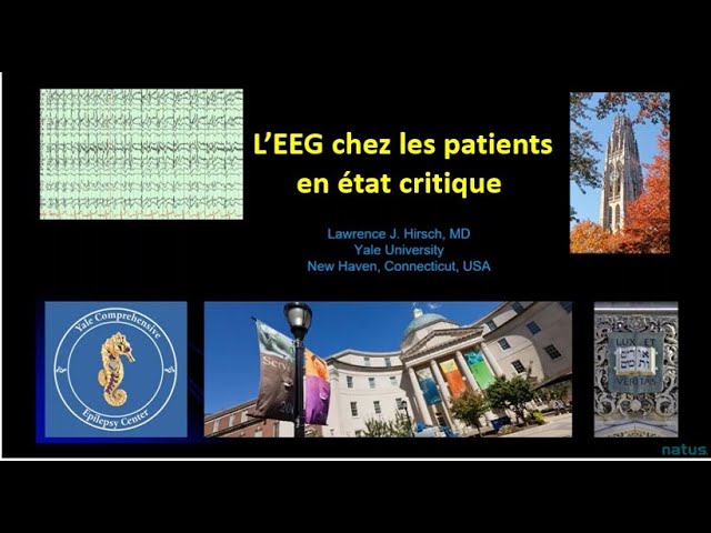 L’EEG chez les patients en état critique