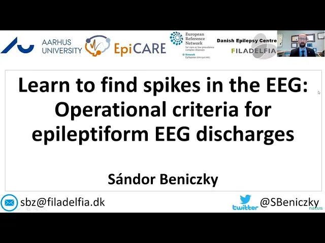 Learn to find spikes in the EEG Operational criteria for interictal epileptiform discharges