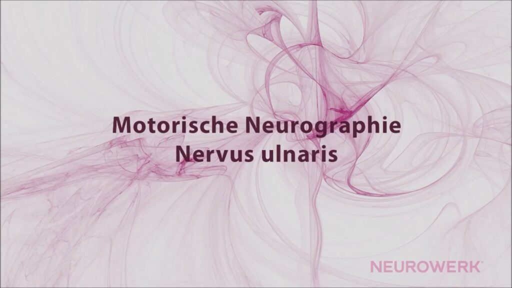 Motorische Neurographie - Ulnaris (German)