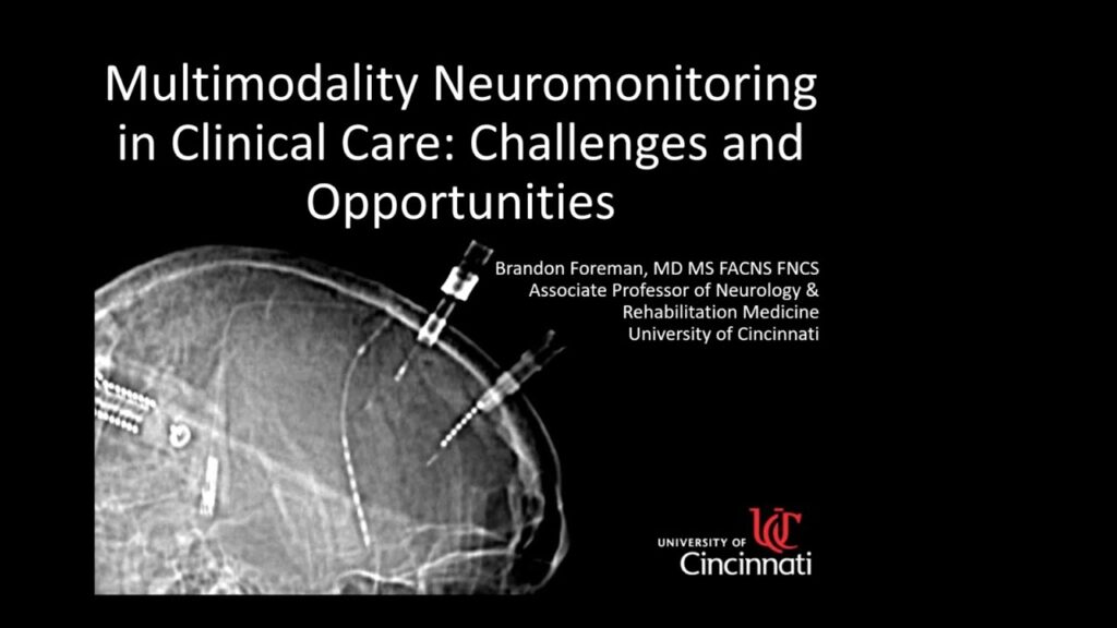 Multimodality Monitoring in Critical Care - Challenges and Opportunities