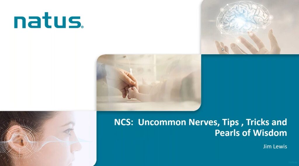 NCS uncommon nerves tips and tricks