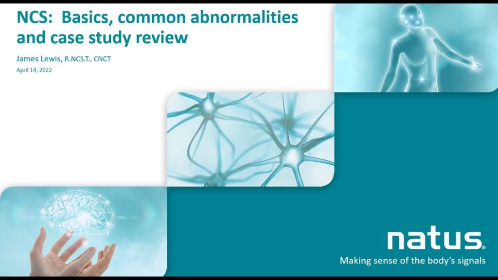 NCS Basics common abnormalities and case study review