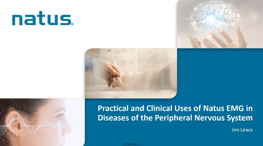 Practical uses and clinical applications of Natus' EMG equipment