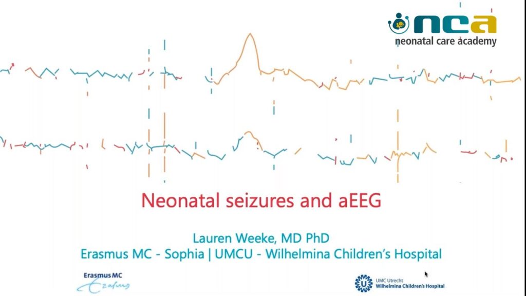 Neonatal Seizures and aEEG monitoring