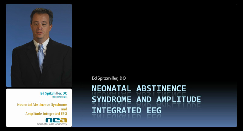 Neonatal Abstinence Syndrome and Amplitude Integrated EEG