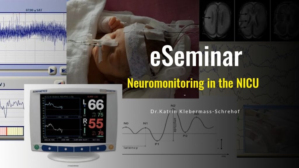 Neuromonitoring in the NICU II