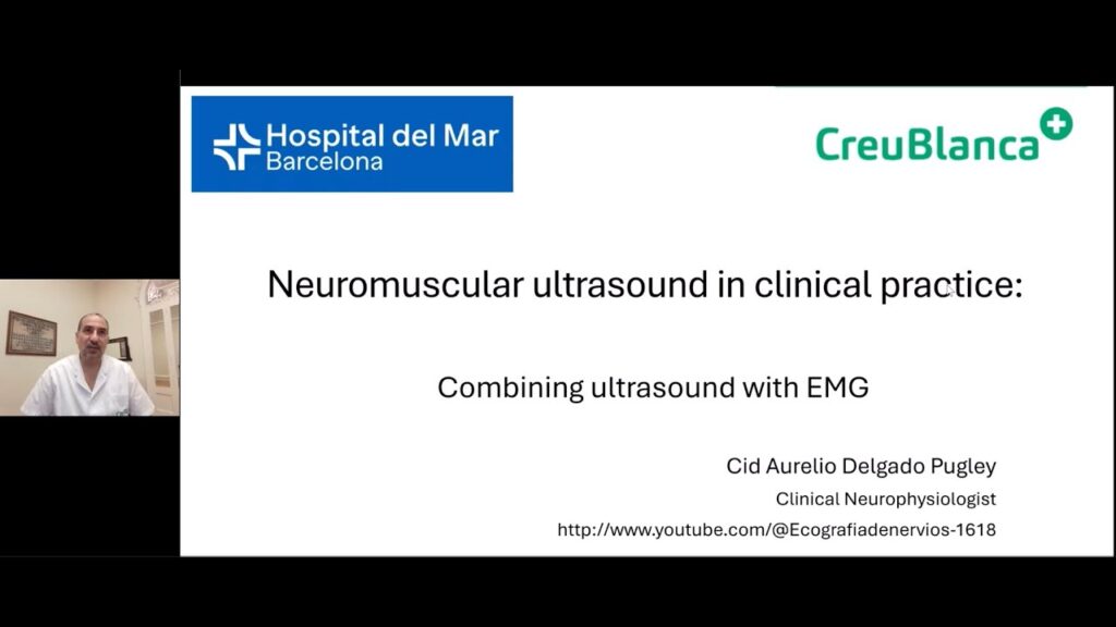 Neuromuscular ultrasound (NMUS) in clinical practice: Combining ultrasound with EMG