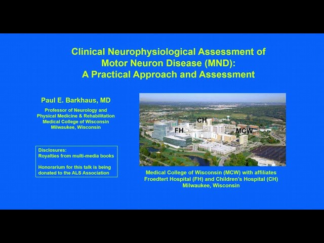 Neurophysiological Assessment of Motor Neuron Disease (MND) - A Practical Approach