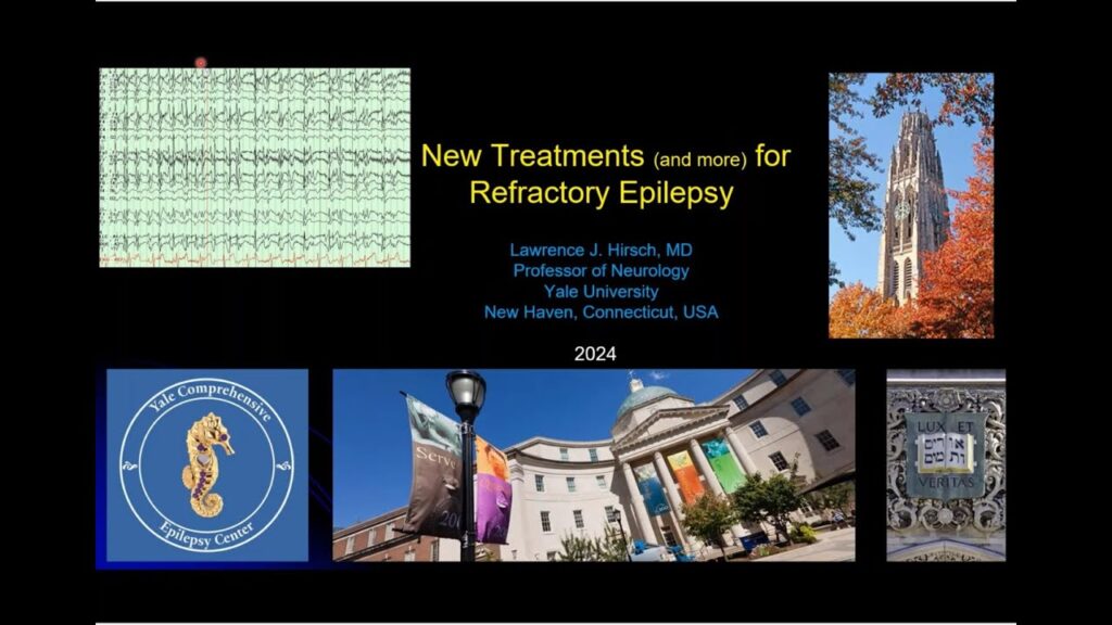 New Treatments for Refractory Epilepsy