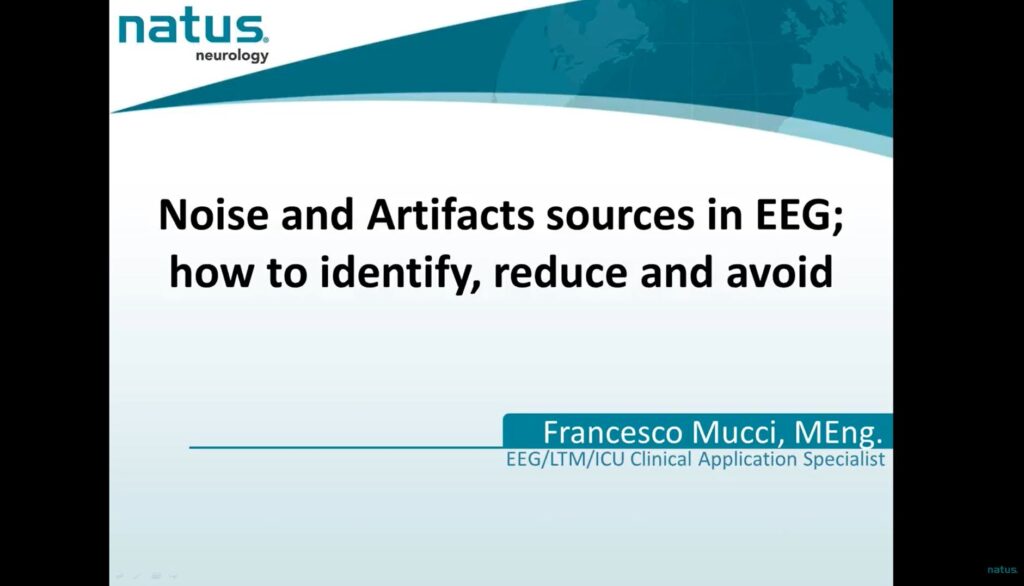 Noise & Artifacts Sources in EEG