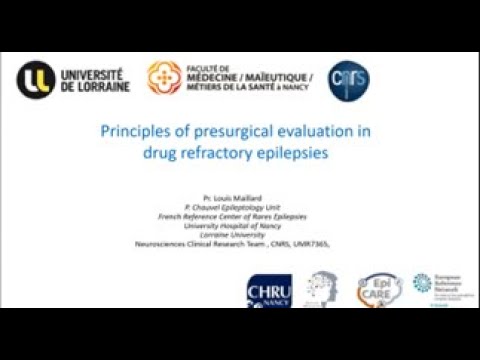Principles of Pre-Surgical Evaluation in Drug Refractory Epilepsy Patients