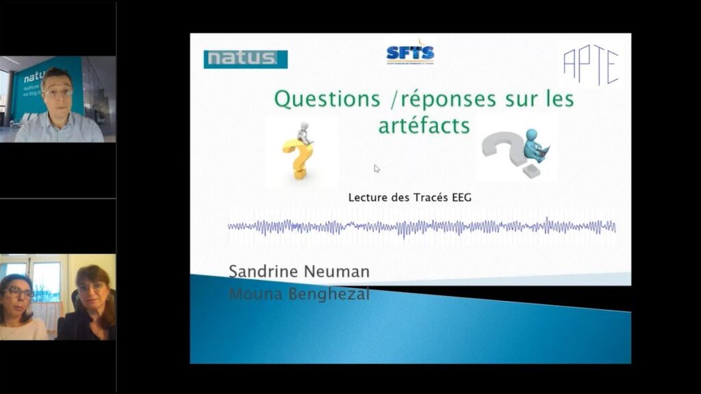 Questions Réponses sur les Artéfacts Lecture des Tracés