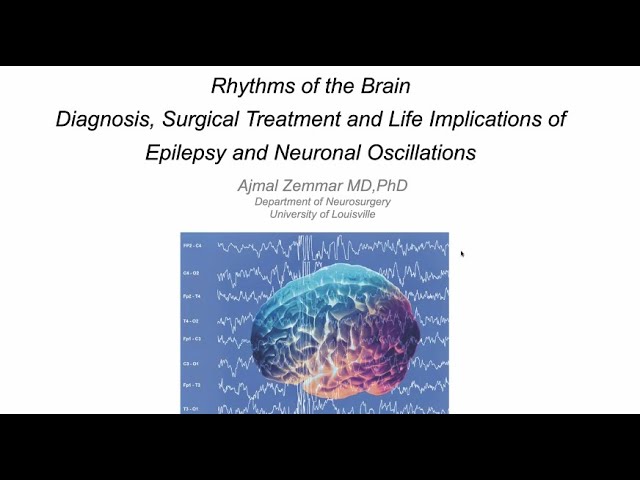 Rhythms of the Brain Diagnosis, Surgical Treatment and Life Implications of Epilepsy