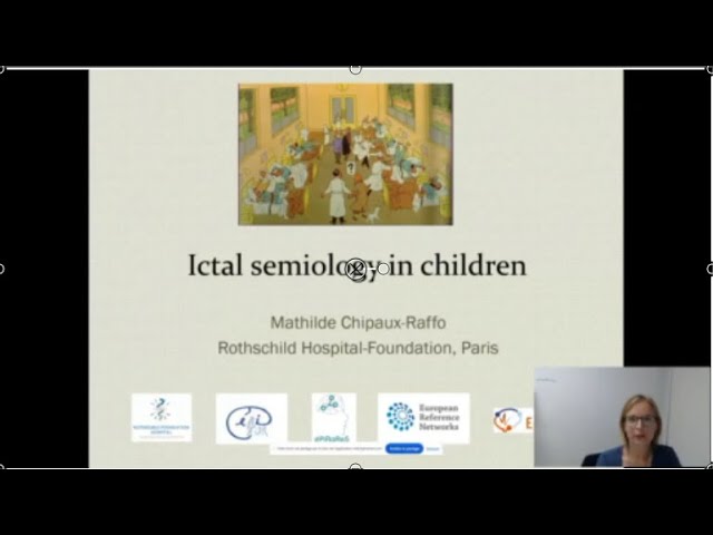 Semiology of focal paediatric seizures