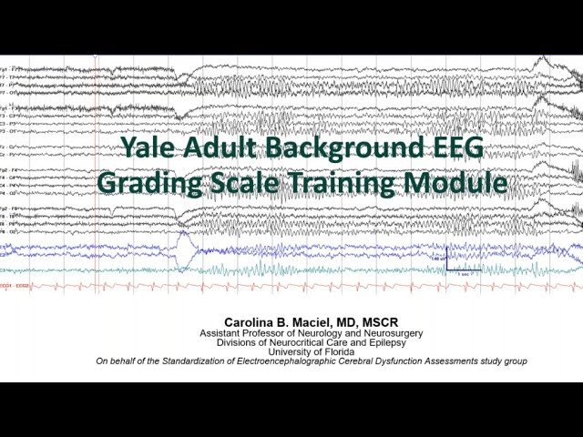 Standardized Approach to Grading Level of Brain Dysfunction on EEG
