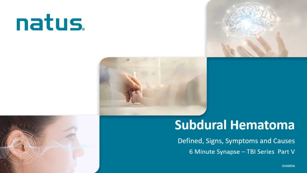 Subdural Hematoma – Traumatic Brain Injury, Part V