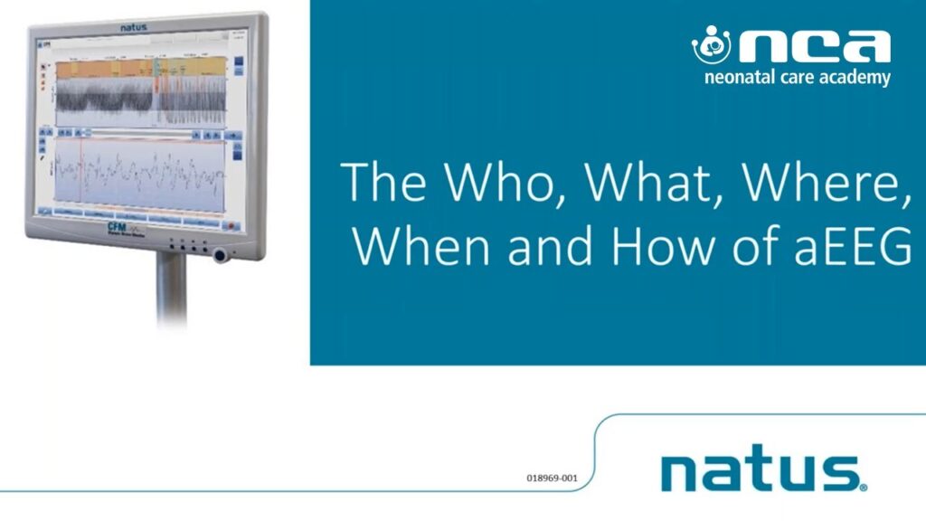 The Who, What, Where, When and How of aEEG