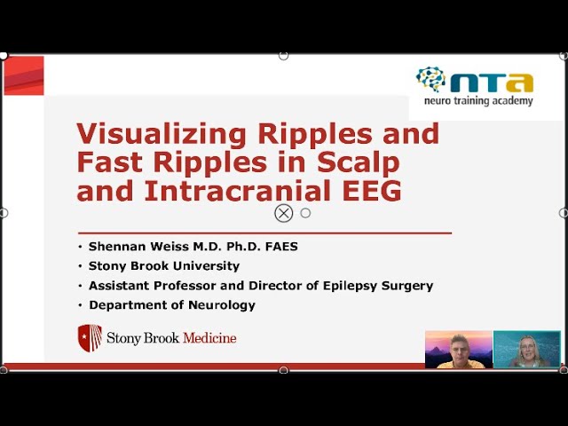 Visualizing Ripples and Fast Ripples in Scalp and Intracranial EEG
