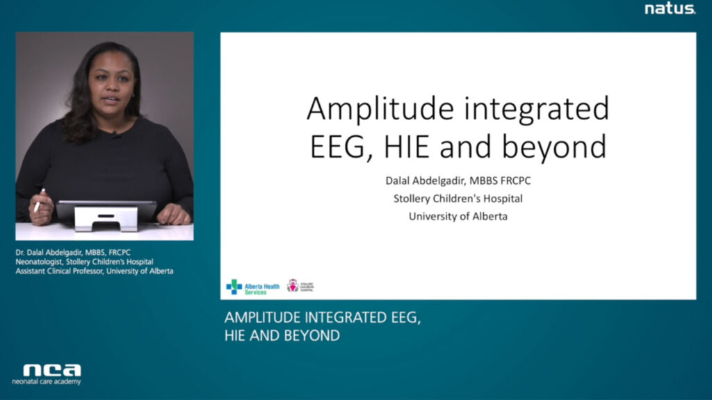 aEEG – HIE and Beyond