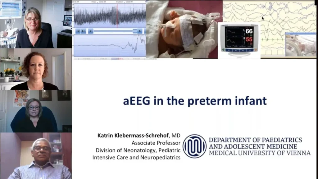 aEEG in preterm infant 1