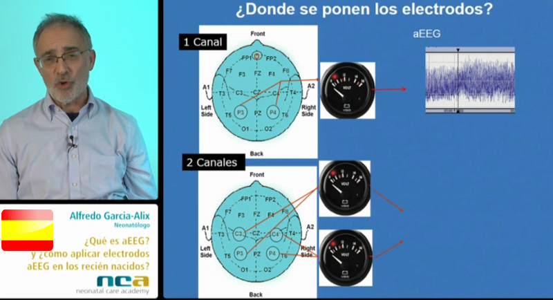 Bases de aEEG (2/5)