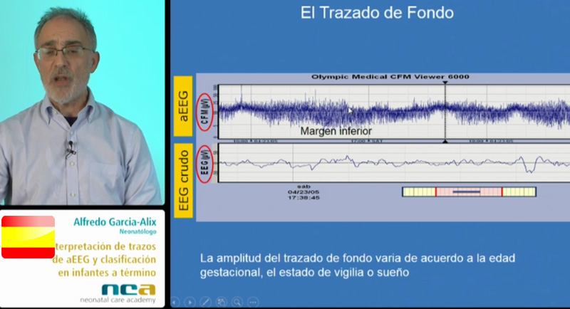 Bases de aEEG (3/5)