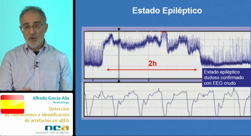 Bases de aEEG (4/5)