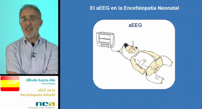 Bases de aEEG (5/5)