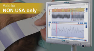 aEEG - Olympic Brainz Monitor (OBM) - On Demand Training (Non USA)