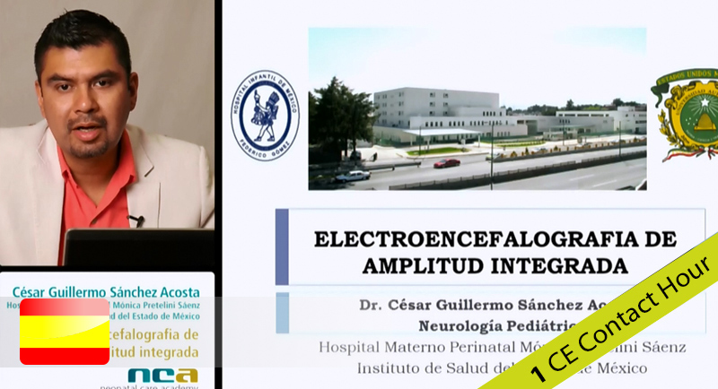 Electroencefalografía de amplitud integrade (aEEG)